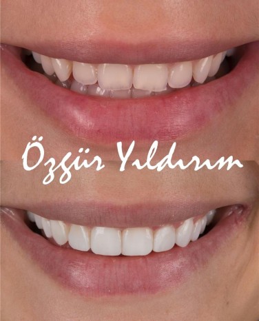 single-06